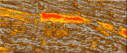 Using Self Organizing Maps to Expose Direct Hydrocarbon Indicators